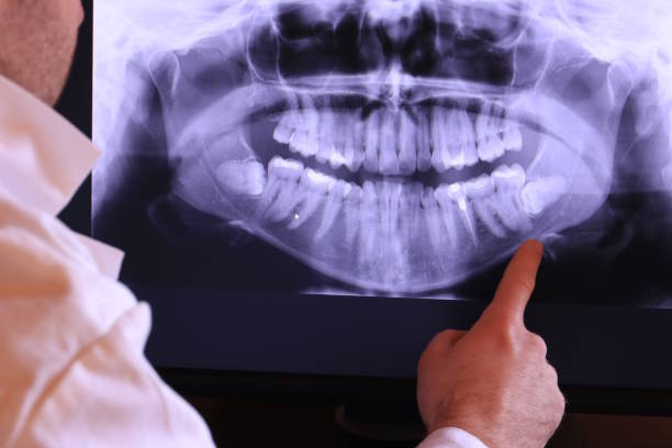 Best Root Canal Emergency Dentist  in Gorevle, IL