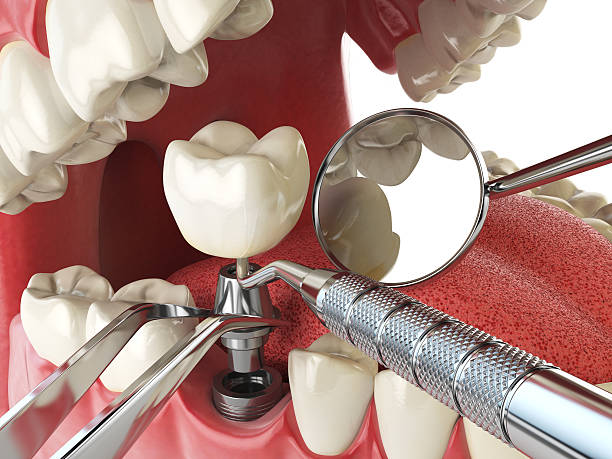 Best Broken Tooth Emergency  in Gorevle, IL